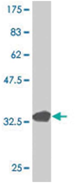 HIST1H3E (A02), Mouse anti-Human, Polyclonal Antibody, Abnova 50&mu;L;