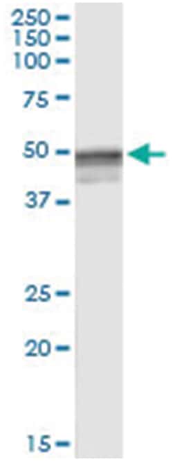 anti-HYAL3, Human, IP-WB Antibody Pair, Abnova&trade;