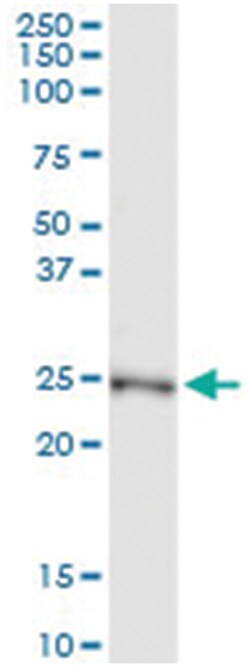 NME5, Human, IP-WB Antibody Pair (PW1), Abnova&trade;