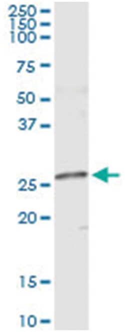 NME5, Human, IP-WB Antibody Pair (PW2), Abnova&trade;