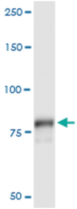anti-PLA2G6, Human, IP-WB Antibody Pair, Abnova&trade;