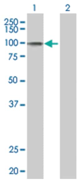 RECK 293T Cell Overexpression Lysate (Denatured), Abnova 100 &mu;L | Buy Online | Abnova | Fisher Scientific