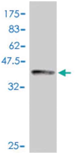 NCK2, Mouse, Polyclonal Antibody, Abnova 50 &mu;L | Buy Online | Abnova | Fisher Scientific