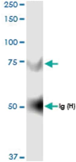 anti-GNPAT, Human, IP-WB Antibody Pair, Abnova&trade;