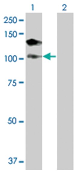 DHX16 293T Cell Overexpression Lysate (Denatured), Abnova 100 &mu;L | Buy Online | Abnova | Fisher Scientific