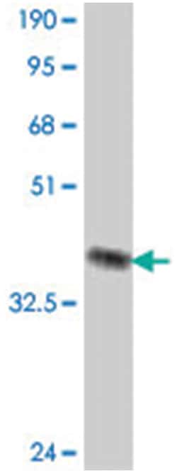 CUL4A, Mouse, Polyclonal Antibody, Abnova 50&mu;L; Unlabeled:Antibodies,