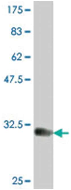 TPST1, Mouse, Polyclonal Antibody, Abnova 50&mu;L; Unlabeled:Antibodies,