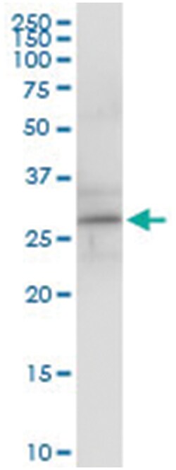 anti-RGS5, Human, IP-WB Antibody Pair, Abnova&trade;