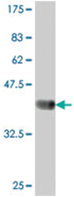 PPFIBP2, Mouse, Polyclonal Antibody, Abnova 50&mu;L; Unlabeled:Antibodies,