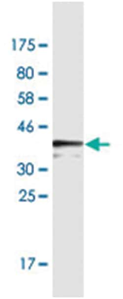PKP4, Mouse, Clone: 4H7, Abnova 200&mu;L; Unlabeled:Antibodies, Monoclonal