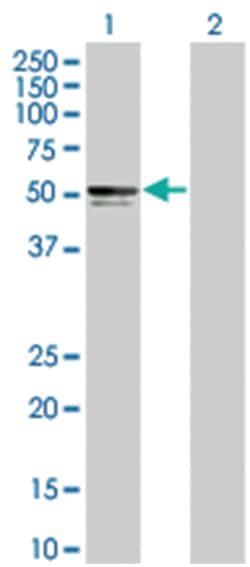 PIK3R3 293T Cell Overexpression Lysate (Denatured), Abnova 100 &mu;L | Buy Online | Abnova | Fisher Scientific