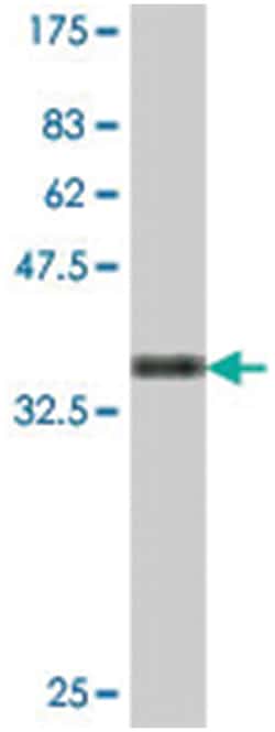 ENC1, Mouse, Polyclonal Antibody, Abnova™