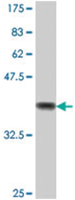 ITGA8, Mouse, Polyclonal Antibody, Abnova 50&mu;L; Unlabeled:Anticuerpos