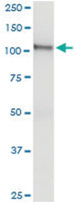 anti-DGKZ, Human, IP-WB Antibody Pair, Abnova&trade;