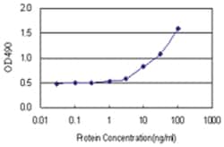 anti-MAPKAPK5 Matched Antibody Pair, Abnova&trade;