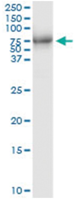 anti-MAPKAPK5, Human, IP-WB Antibody Pair, Abnova™