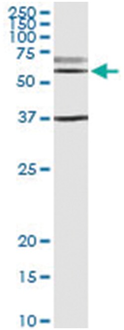 anti-CDC14B, Human, IP-WB Antibody Pair, Abnova 1 Set:Antibodies, Monoclonal/Polyclonal