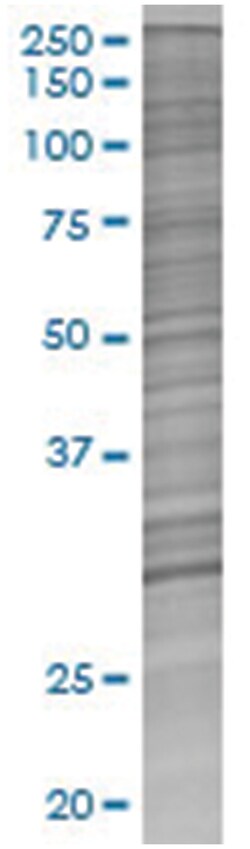 DENR 293T Cell Overexpression Lysate (Denatured), Abnova