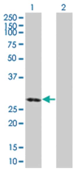 DENR 293T Cell Overexpression Lysate (Denatured), Abnova
