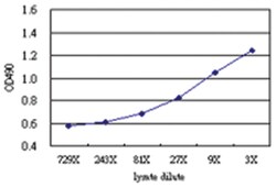 anti-MKNK1 Matched Antibody Pair, Abnova&trade;