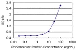 anti-AKR7A2 Matched Antibody Pair, Abnova