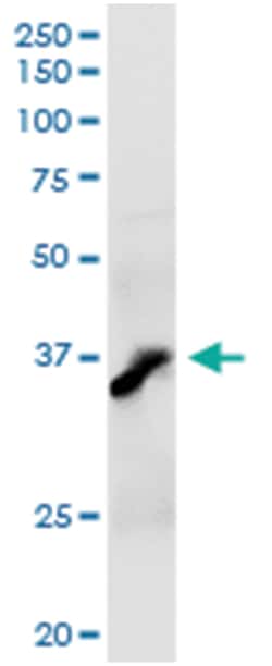 AKR7A2, Human, IP-WB Antibody Pair (PW3), Abnova&trade;