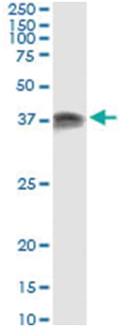PRKRA, Human, IP-WB Antibody Pair (PW2), Abnova&trade;