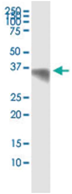 PRKRA, Human, IP-WB Antibody Pair (PW3), Abnova 1 Set:Antibodies, Monoclonal/Polyclonal