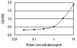 STK16, Human, Matched Antibody Pair (AP21), Abnova™