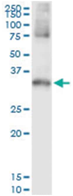 anti-STK16, Human, IP-WB Antibody Pair, Abnova&trade;