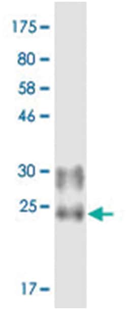 anti-TNFSF11, Clone: 8E5., Abnova 100 &mu;g | Buy Online | Abnova Corporation | Fisher Scientific