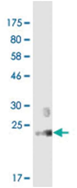 anti-TNFSF11, Clone: 3F1, Abnova 100 &mu;g | Buy Online | Abnova Corporation | Fisher Scientific