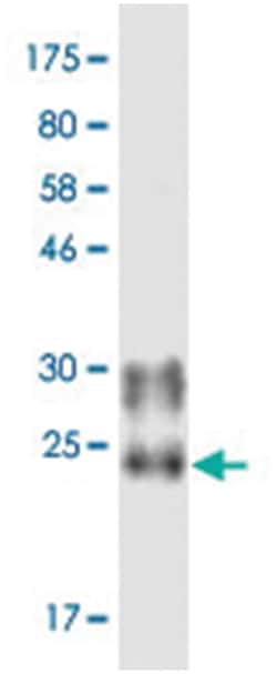 anti-TNFSF11, Clone: 7D6, Abnova 100 &mu;g | Buy Online | Abnova Corporation | Fisher Scientific