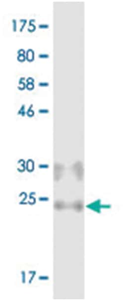 anti-TNFSF11, Clone: 4H3, Abnova 100 &mu;g | Buy Online | Abnova Corporation | Fisher Scientific