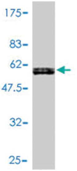 KLF7, Mouse, Polyclonal Antibody, Abnova 50&mu;L; Unlabeled:Antibodies,