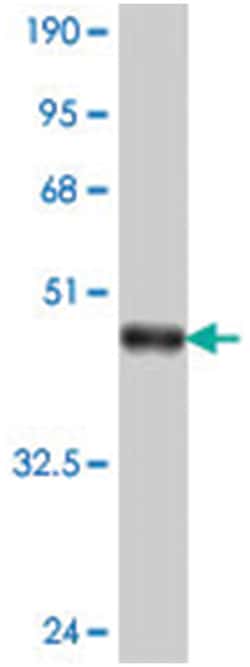 PCDHGB4, Mouse, Polyclonal Antibody, Abnova 50 &mu;L | Buy Online | Abnova Corporation | Fisher Scientific