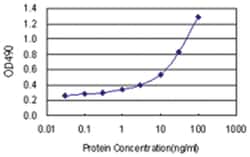 ALDH4A1, Human, Matched Antibody Pair (AP21), Abnova&trade;