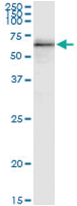 anti-ALDH4A1, Human, IP-WB Antibody Pair, Abnova&trade;