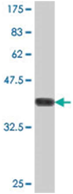 SLC4A4, Mouse, Polyclonal Antibody, Abnova 50&mu;L; Unlabeled:Antibodies,
