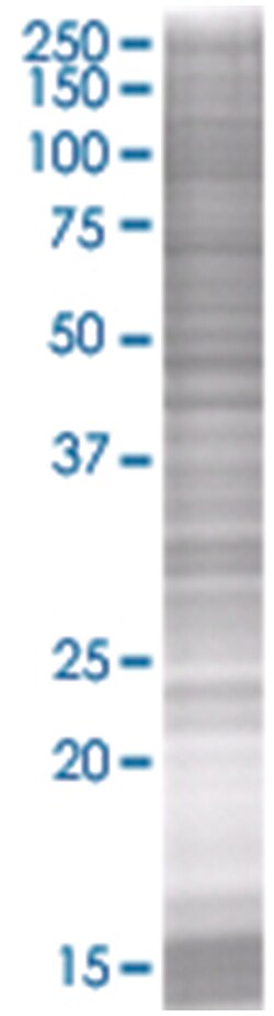 VAMP8 293T Cell Overexpression Lysate (Denatured), Abnova 100 &mu;L | Buy Online | Abnova | Fisher Scientific