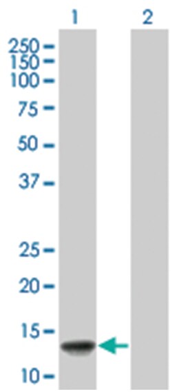 VAMP8 293T Cell Overexpression Lysate (Denatured), Abnova 100 &mu;L | Buy Online | Abnova | Fisher Scientific