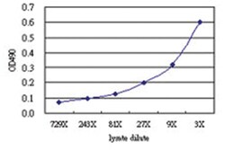 anti-B4GALT4 Matched Antibody Pair, Abnova&trade;
