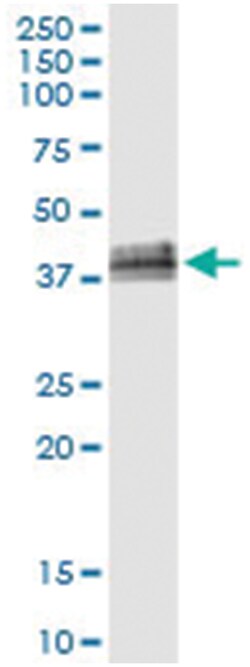 anti-B4GALT4, Human, IP-WB Antibody Pair, Abnova™