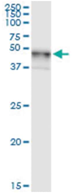 anti-B4GALT3, Human, IP-WB Antibody Pair, Abnova&trade;