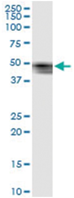 SERPINB7, Human, IP-WB Antibody Pair (PW1), Abnova&trade;