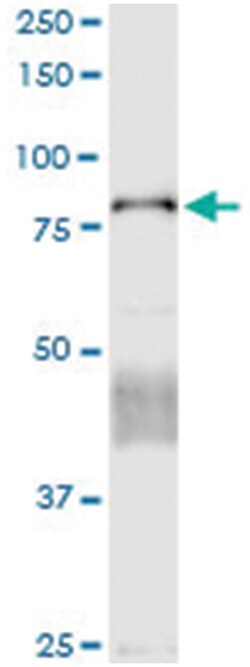 anti-CTNNAL1, Human, IP-WB Antibody Pair, Abnova&trade;