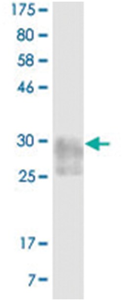 anti-TNFRSF14, Clone: 3B2, Abnova 100 &mu;g | Buy Online | Abnova Corporation | Fisher Scientific