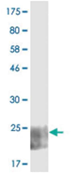 anti-TNFRSF14, Clone: 1E4., Abnova 100 &mu;g | Buy Online | Abnova | Fisher Scientific