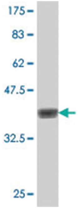 RIPK2, Mouse, Polyclonal Antibody, Abnova 50&mu;L; Unlabeled:Antibodies,