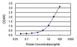 RIOK3, Human, Matched Antibody Pair (AP11), Abnova™